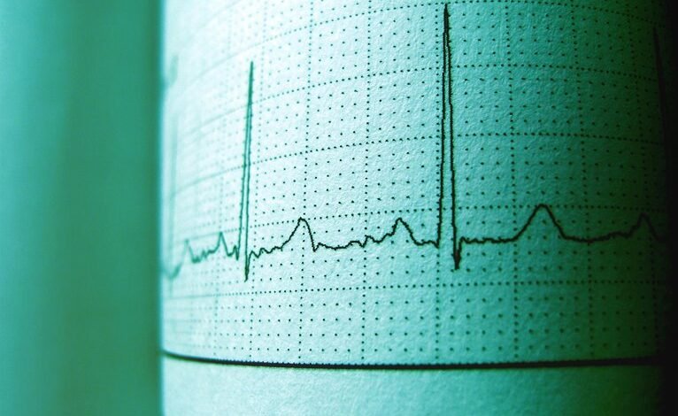 cbd effects on heart rate