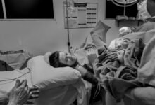 cbd use before surgery